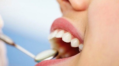 Gum Disease Treatment Ealing