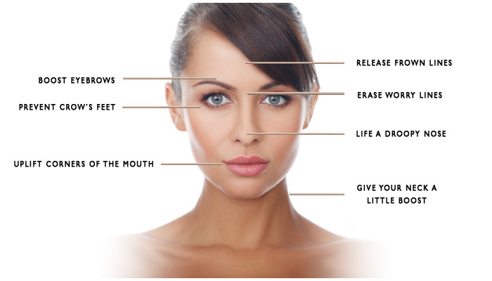 What parts of the face can receive Botox injections
