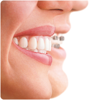 ealing orthodontist