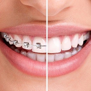 Ealing orthodontics