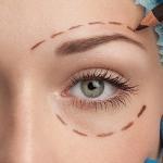 Non Surgical Eyelid Correction ealing